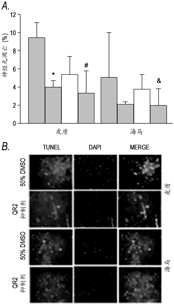 Quinone reductase 2 inhibitors for use as neuroprotective agents