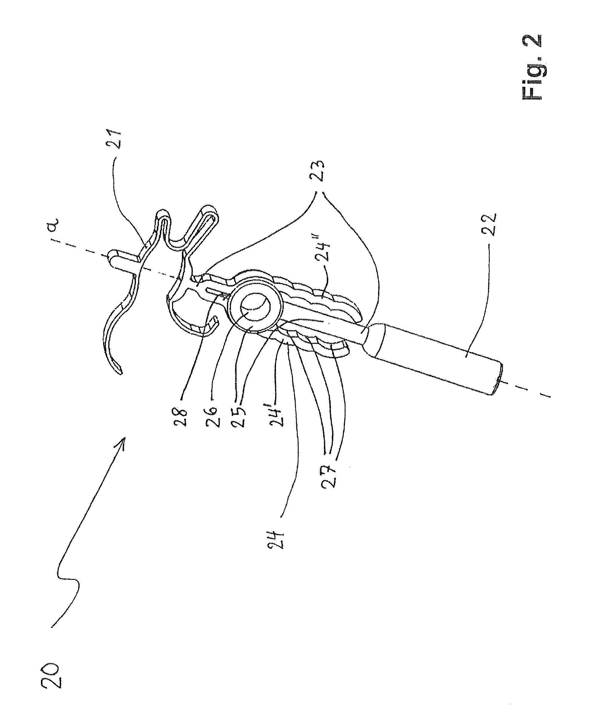 Variable-length passive ossicular prosthesis