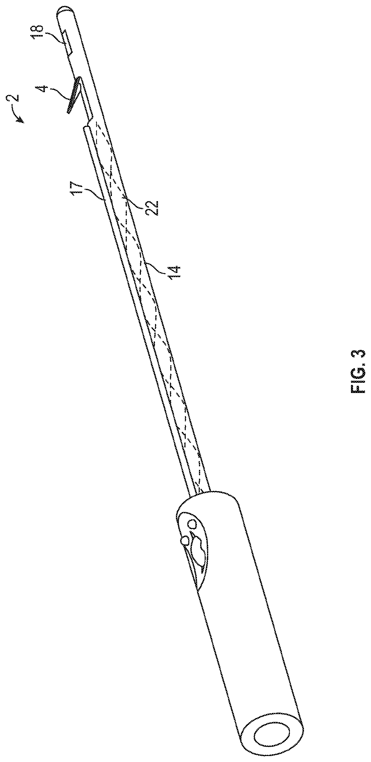 Devices and methods for reducing the appearance of cellulite