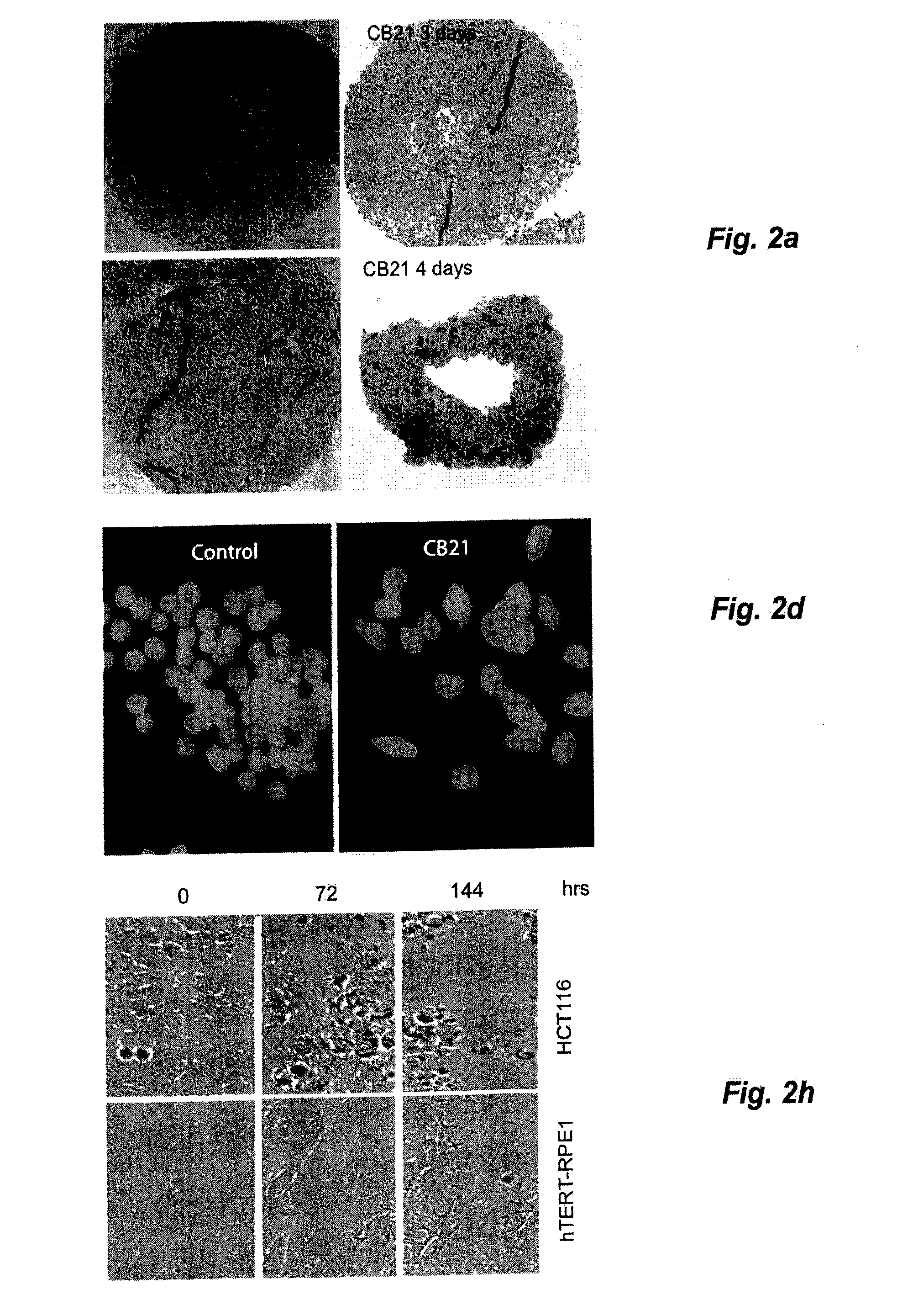 Treatment of Solid Tumours