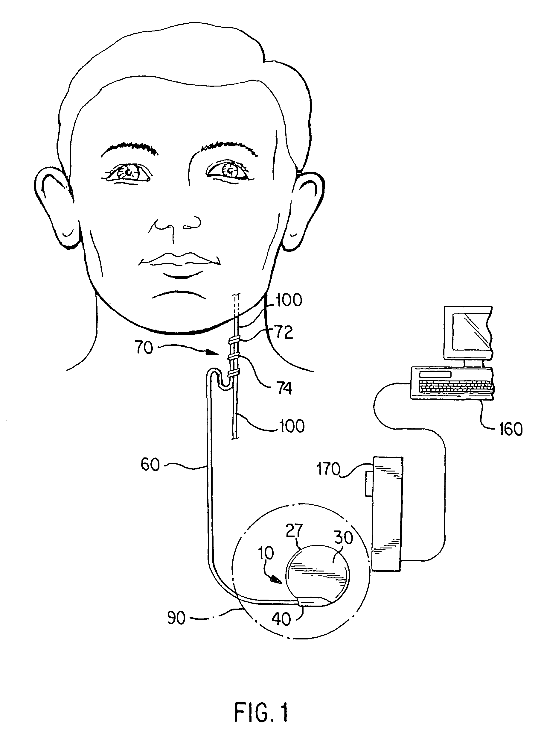 Cranial nerve stimulation to treat a vocal cord disorder