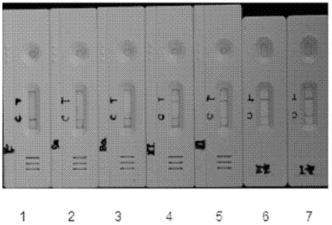 Application of monoclonal antibody for Riemerella anatipestifer in preparation of immune colloidal gold test paper