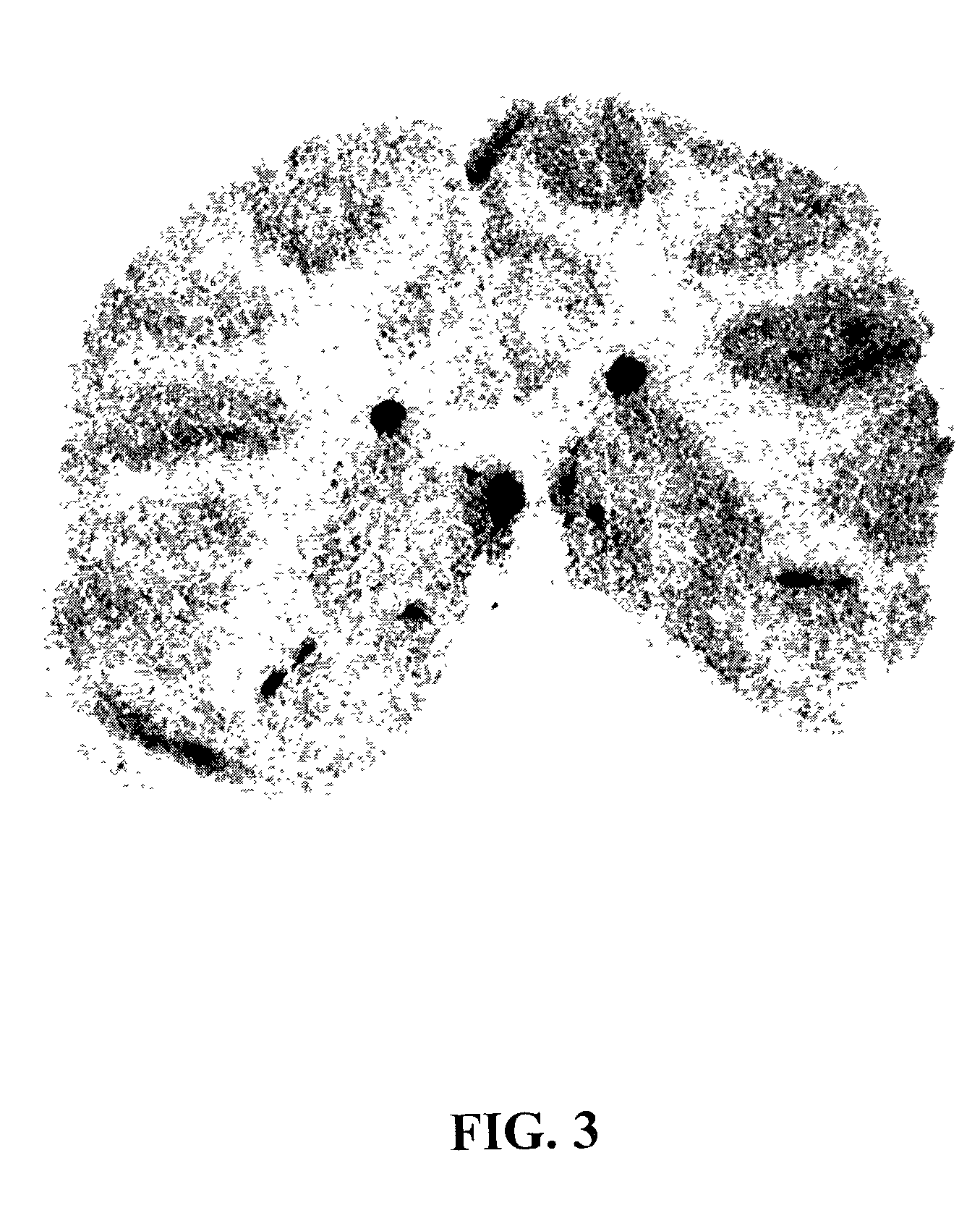 Delivery of pharmaceutical agents via the human insulin receptor