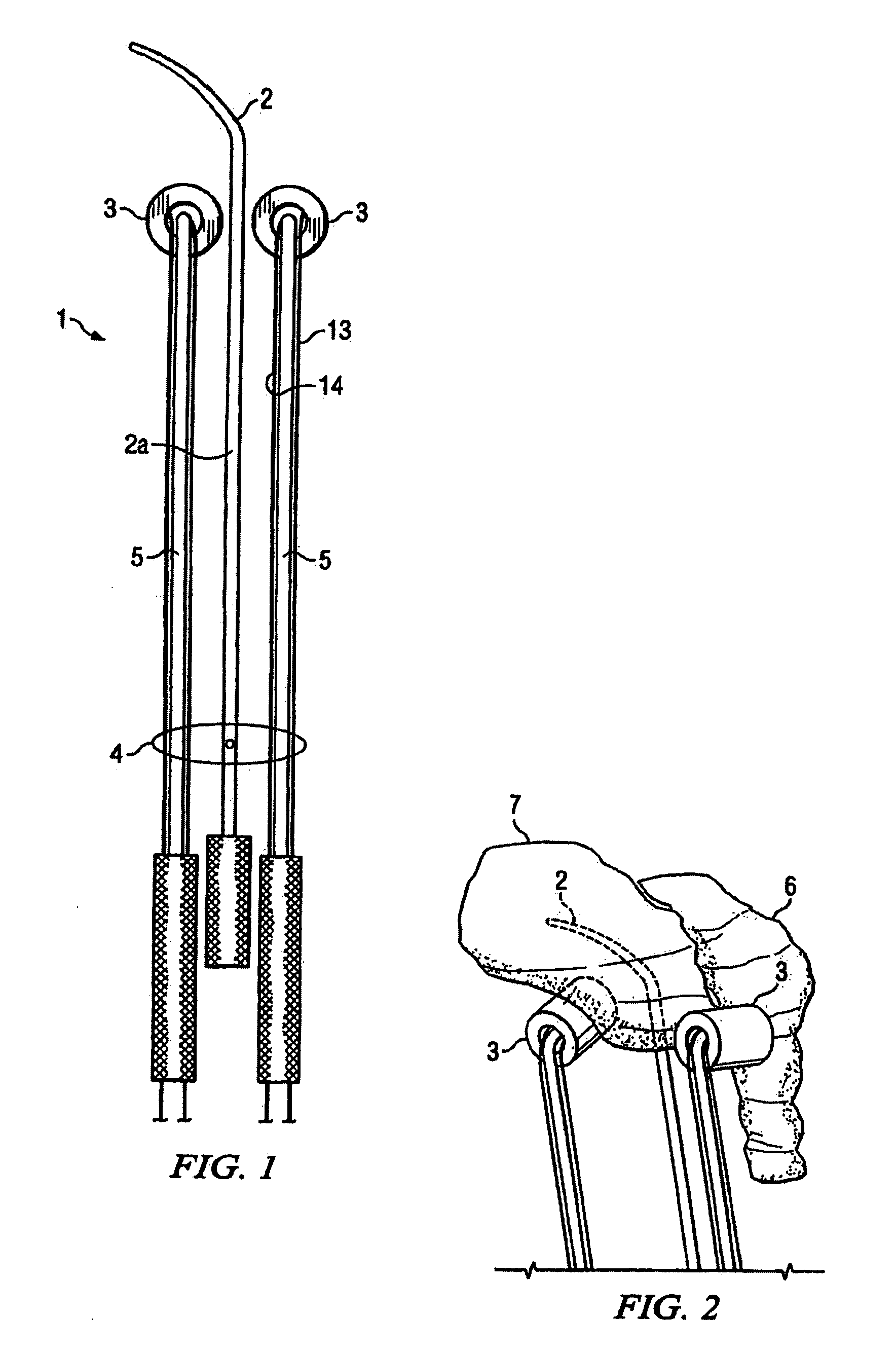 Adaptive intracavitary brachytherapy applicator