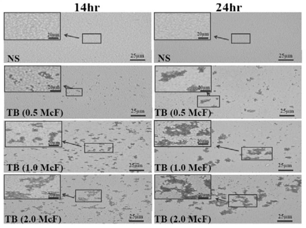 Preparation method and application of mc-arms-mmb triple technology in drug-resistant tuberculosis diagnostic kit