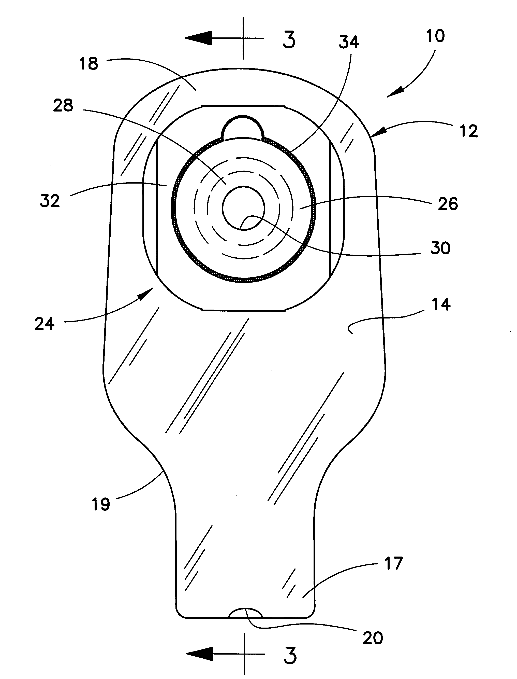 Ostomy pouch