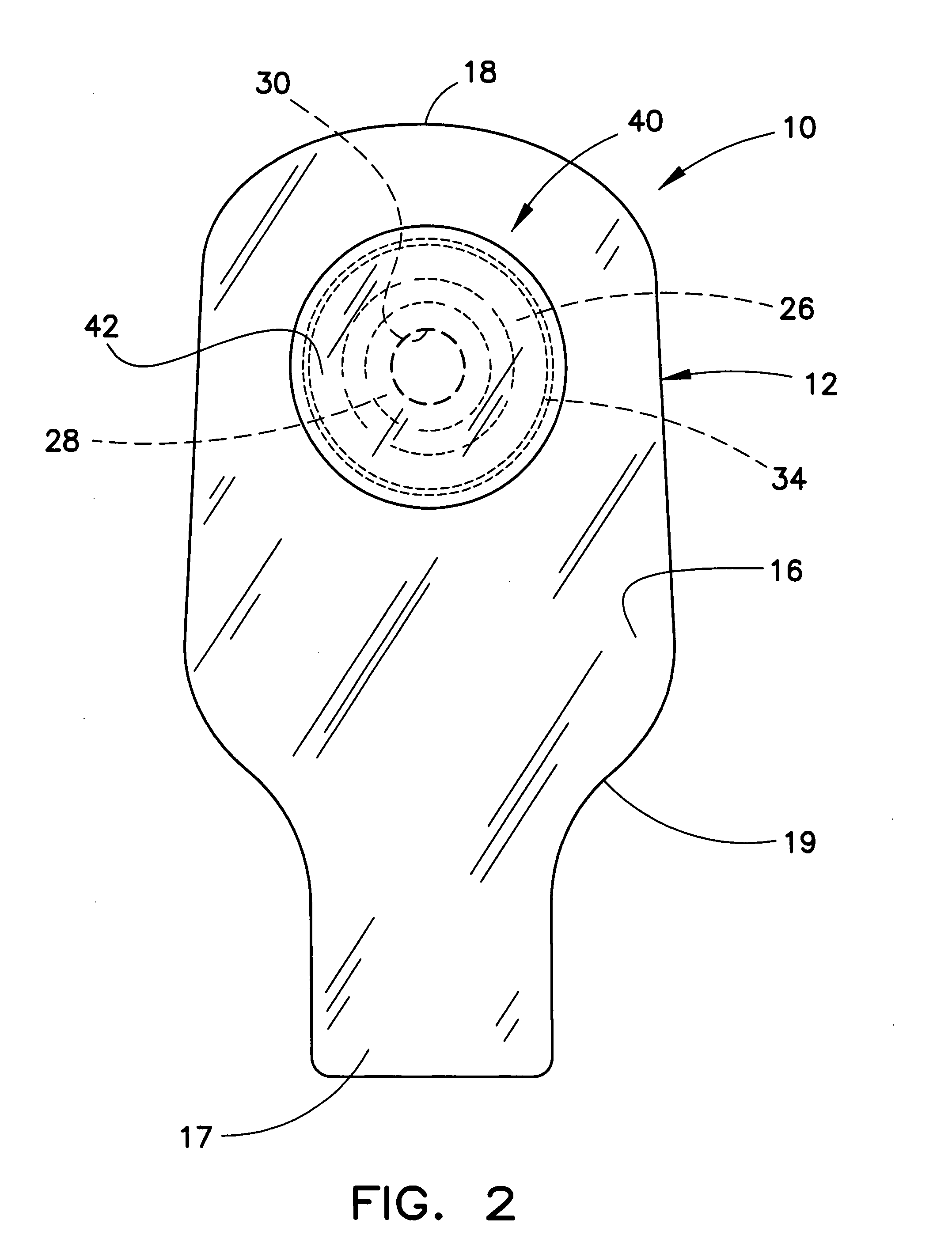 Ostomy pouch