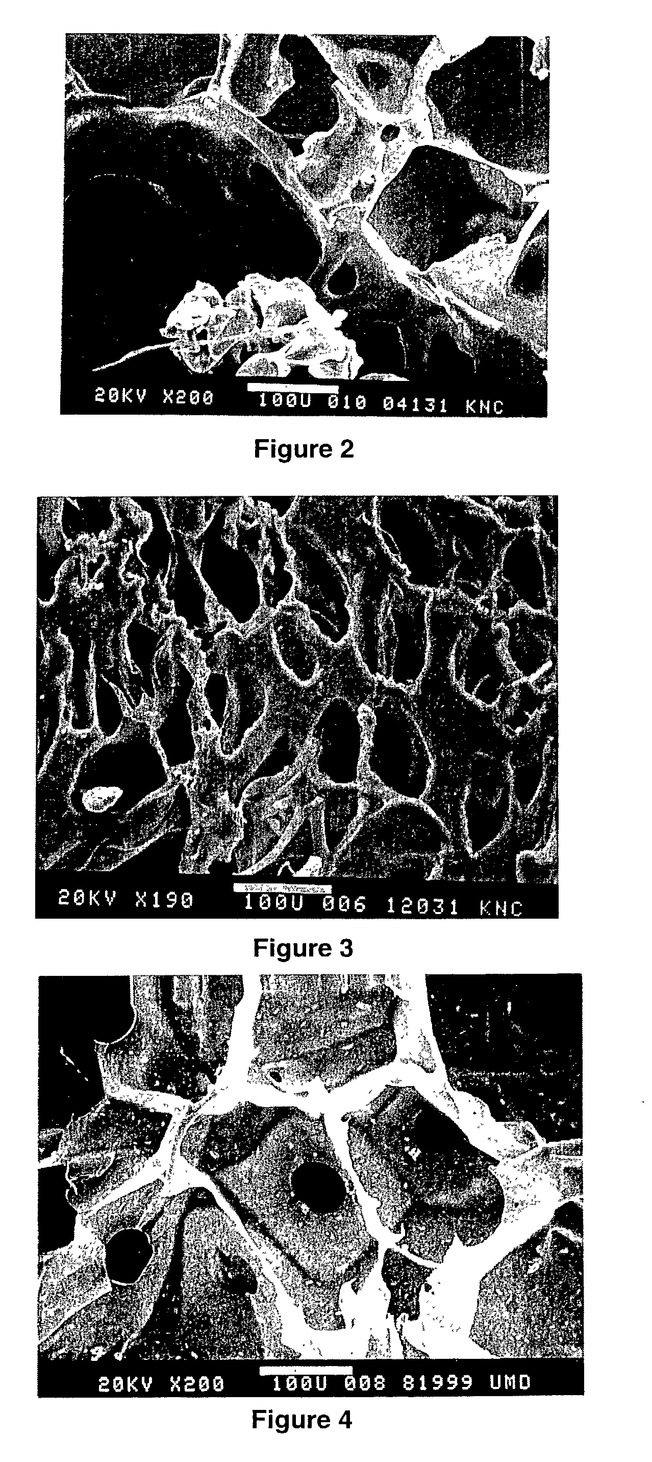 Resorbable structure for treating and healing of tissue defects