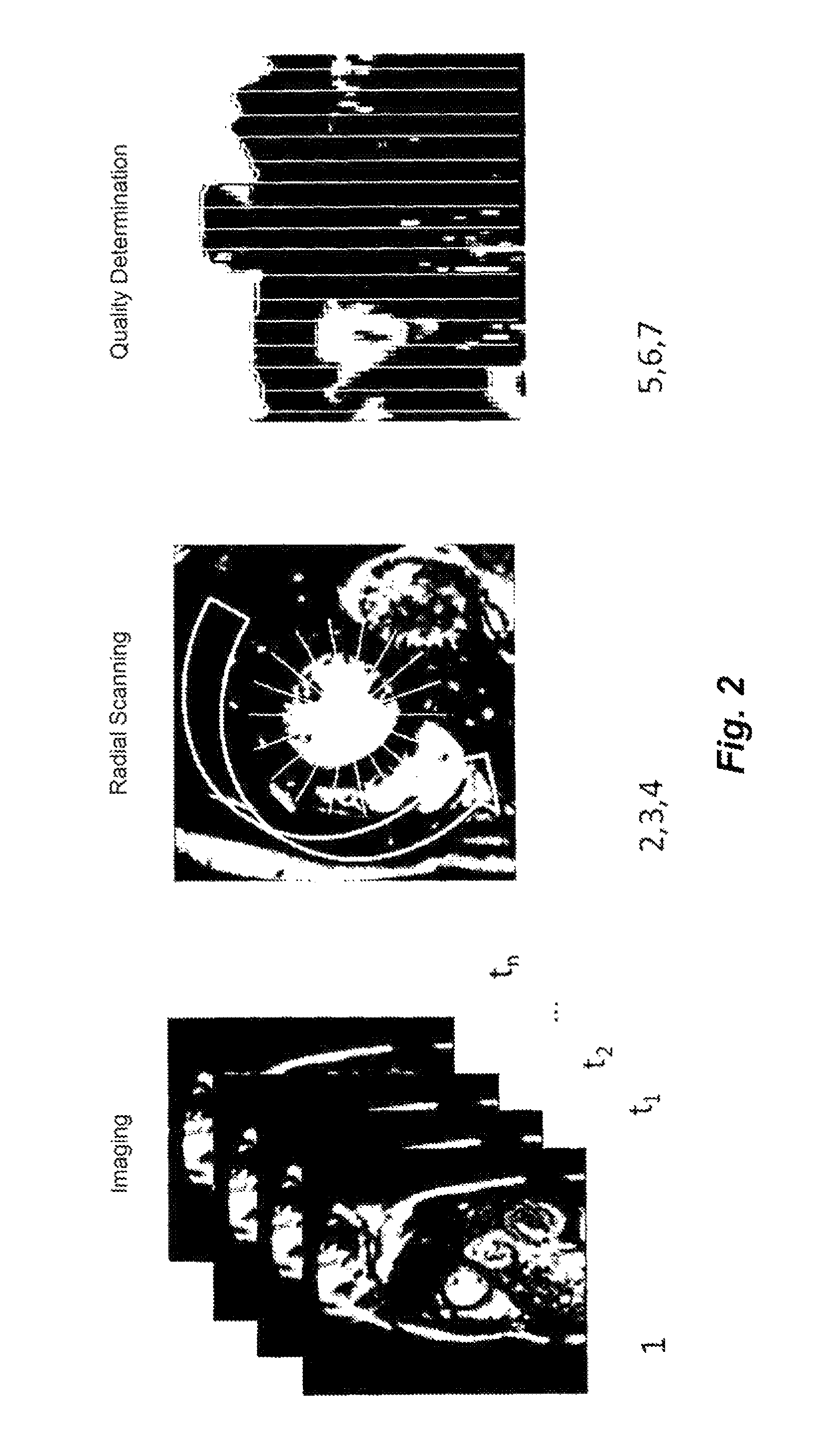 Quantification of the image quality for the motion-synchronized capture of a cross-sectional tomographic picture of an object