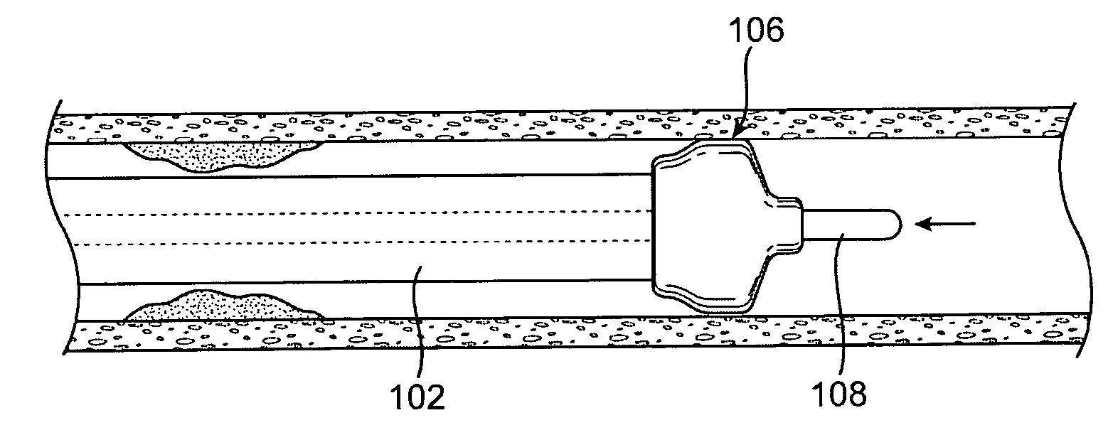 Device with actuatable fluid-column occluder for prevention of embolization