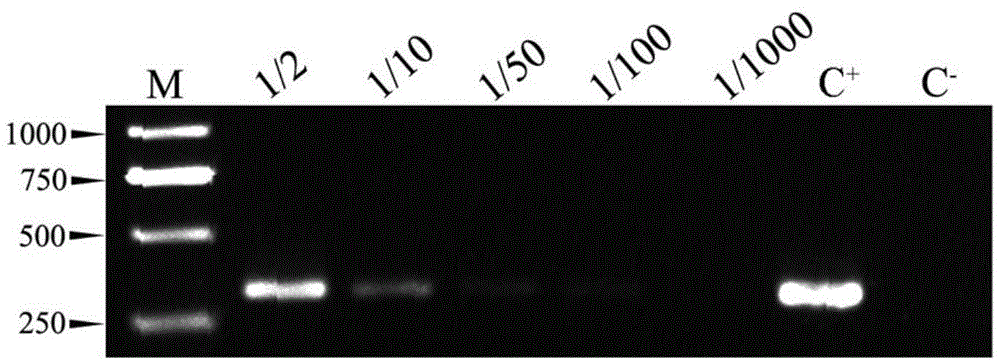 Polymerase chain reaction (PCR) detection method of specificity of botrytis cinerea