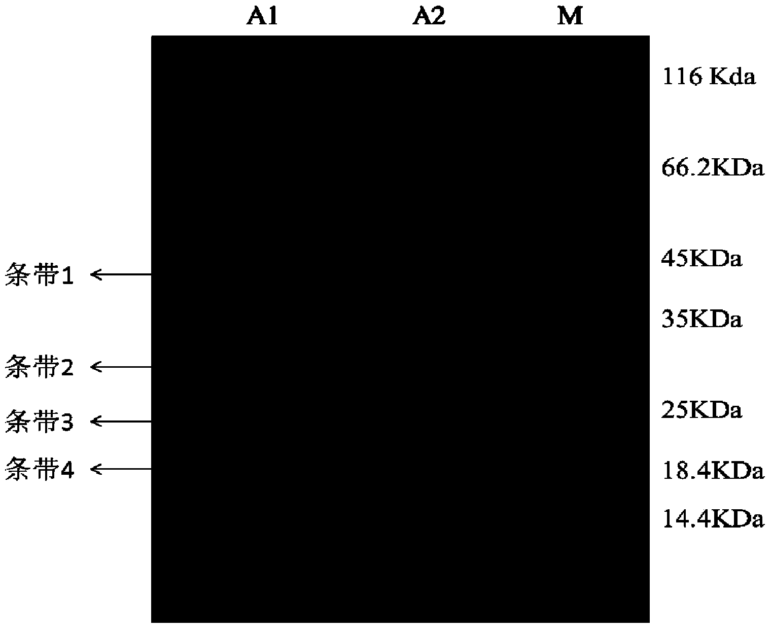 ZEN (zearalenone) toxin degrading enzyme Oxa of acinetobacter as well as coding gene and application thereof