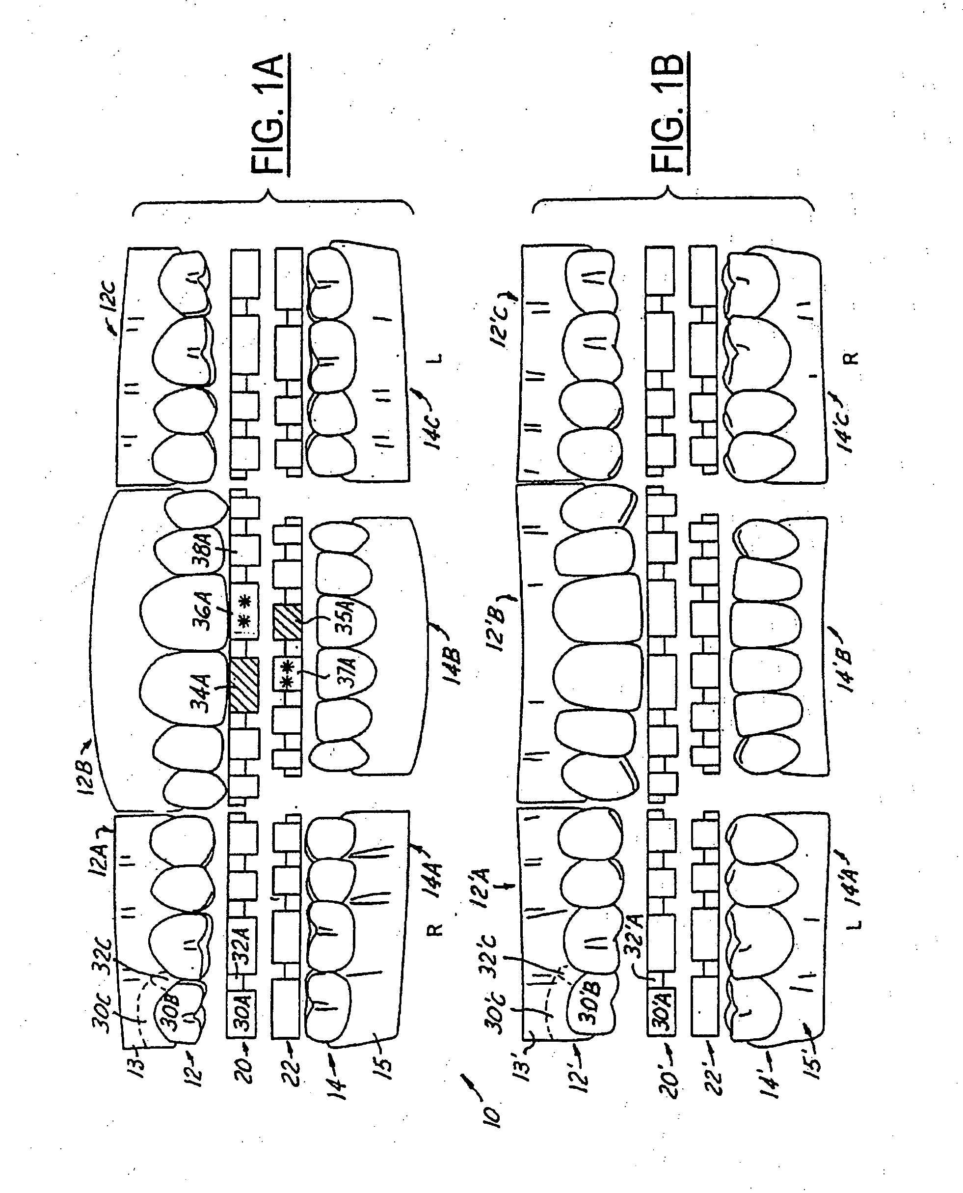 Method and system for periodontal charting