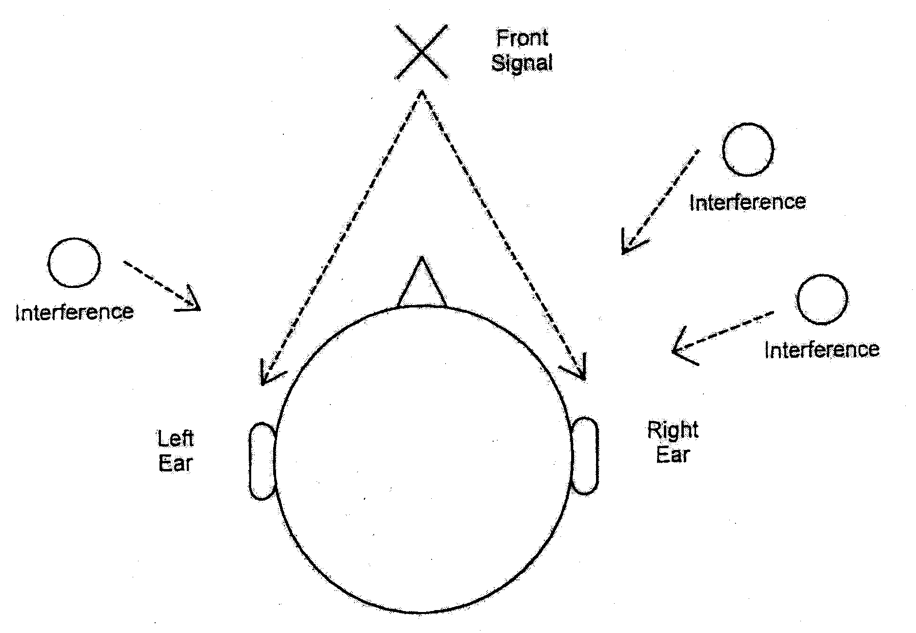 Binaural signal enhancement system