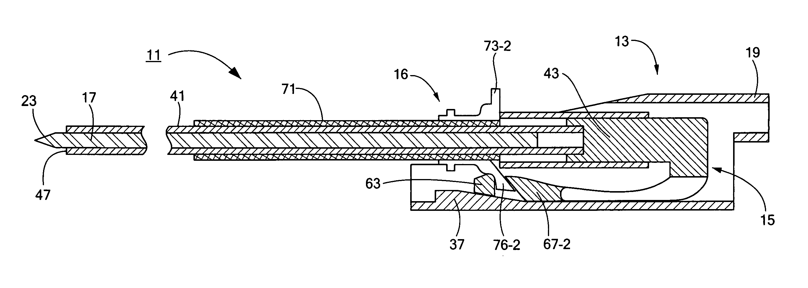 Percutaneous endoscopic jejunostomy access needle