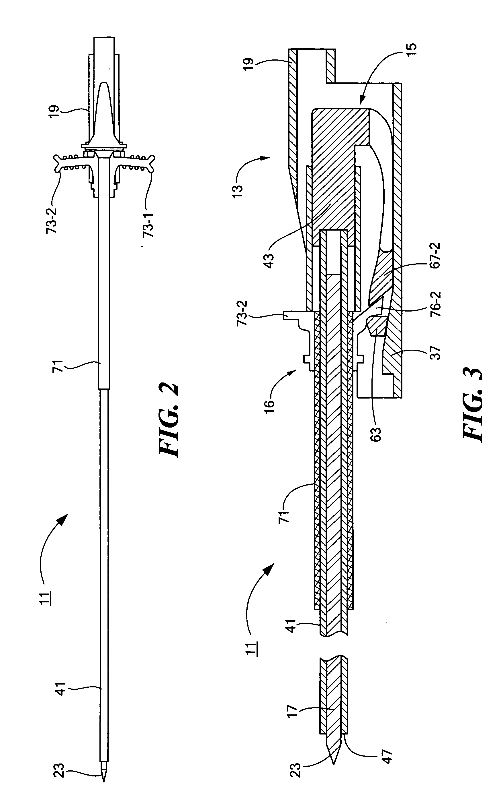 Percutaneous endoscopic jejunostomy access needle