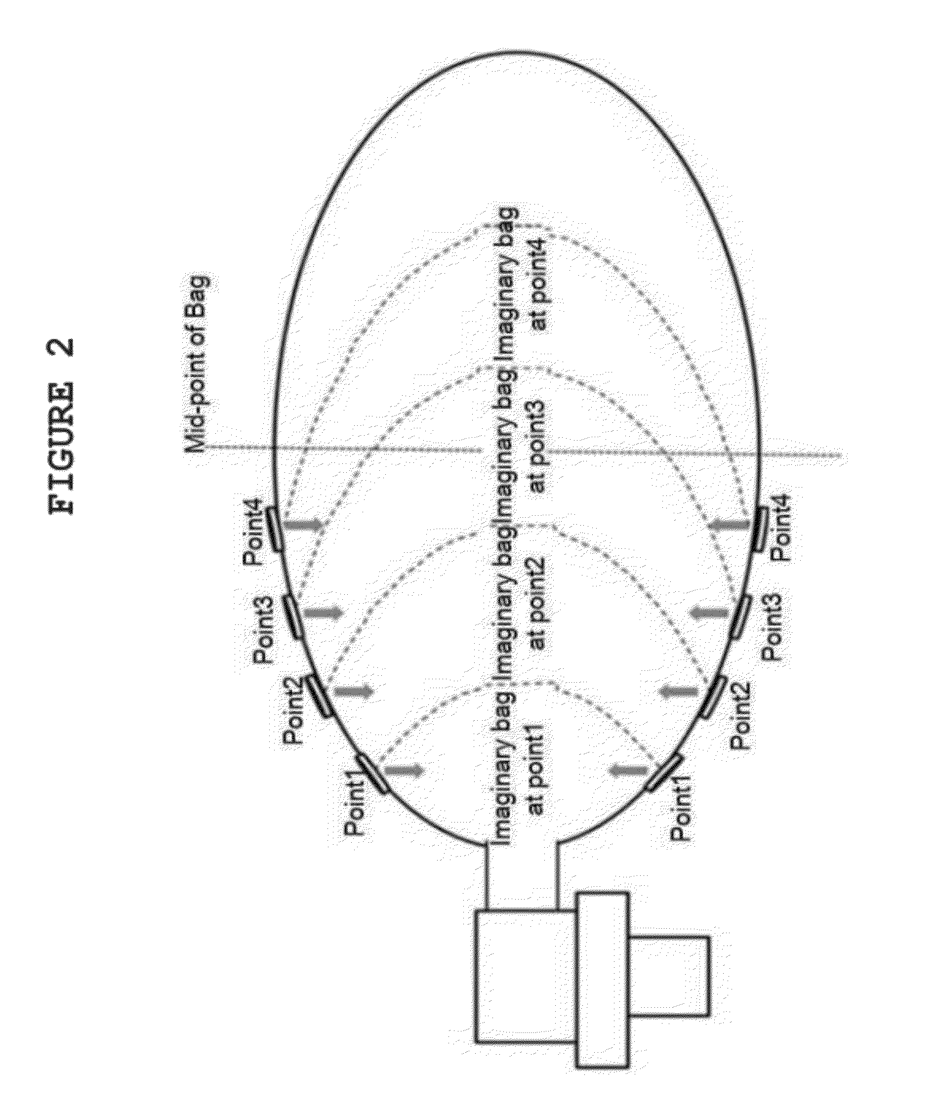 Novel self-inflating bag with specific compression marks for pediatric and adolescent resuscitation