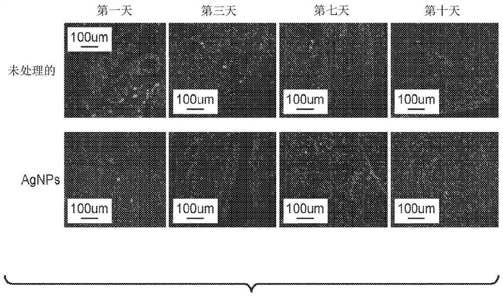 Compositions and methods for neuroprotection utilizing nanoparticulate silver