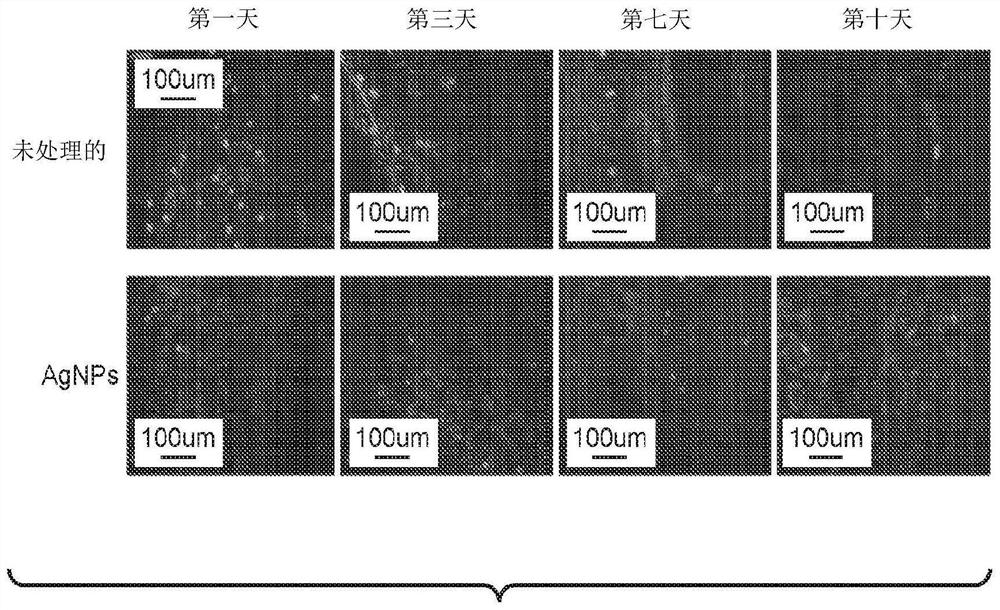 Compositions and methods for neuroprotection utilizing nanoparticulate silver