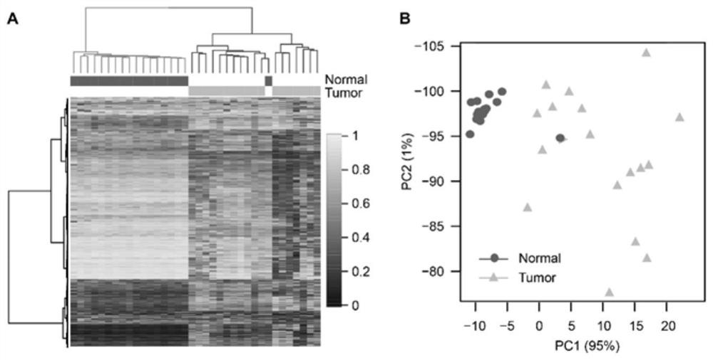 Lung cancer DNA methylation molecular markers and application thereof in preparation of kit for early diagnosis of lung cancer