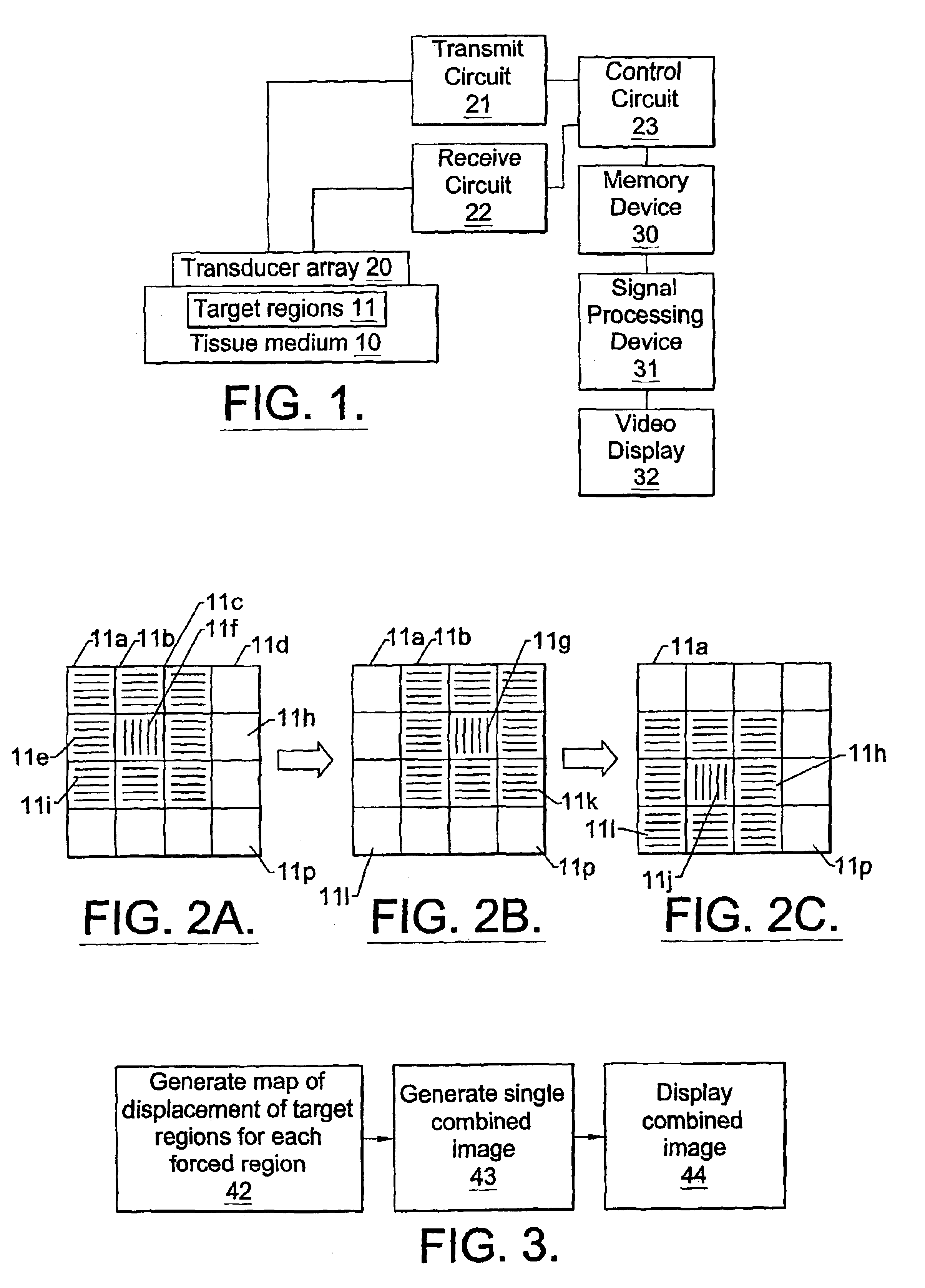 Method and apparatus for the identification and characterization of regions of altered stiffness