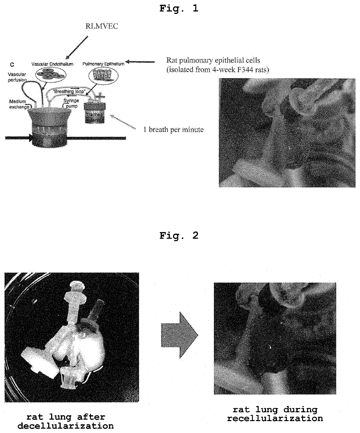 Disease model