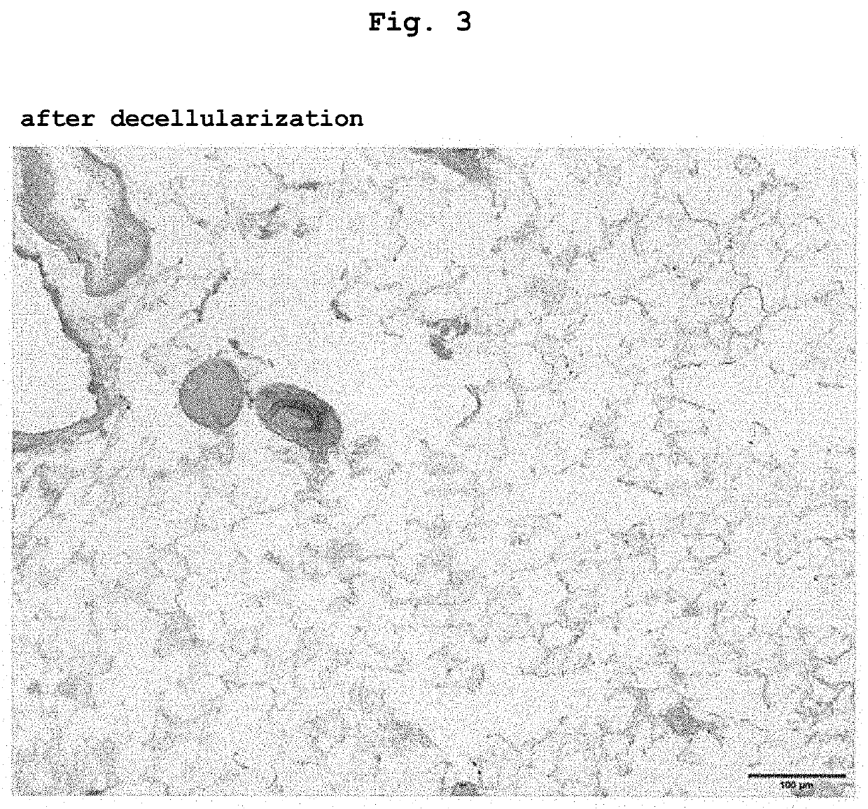 Disease model