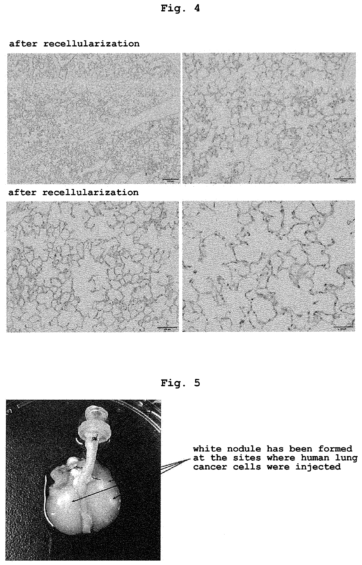 Disease model