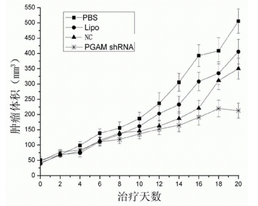 Diagnosis reagent for primary hepatocellular carcinoma, reagent kit and prevention and cure medicaments