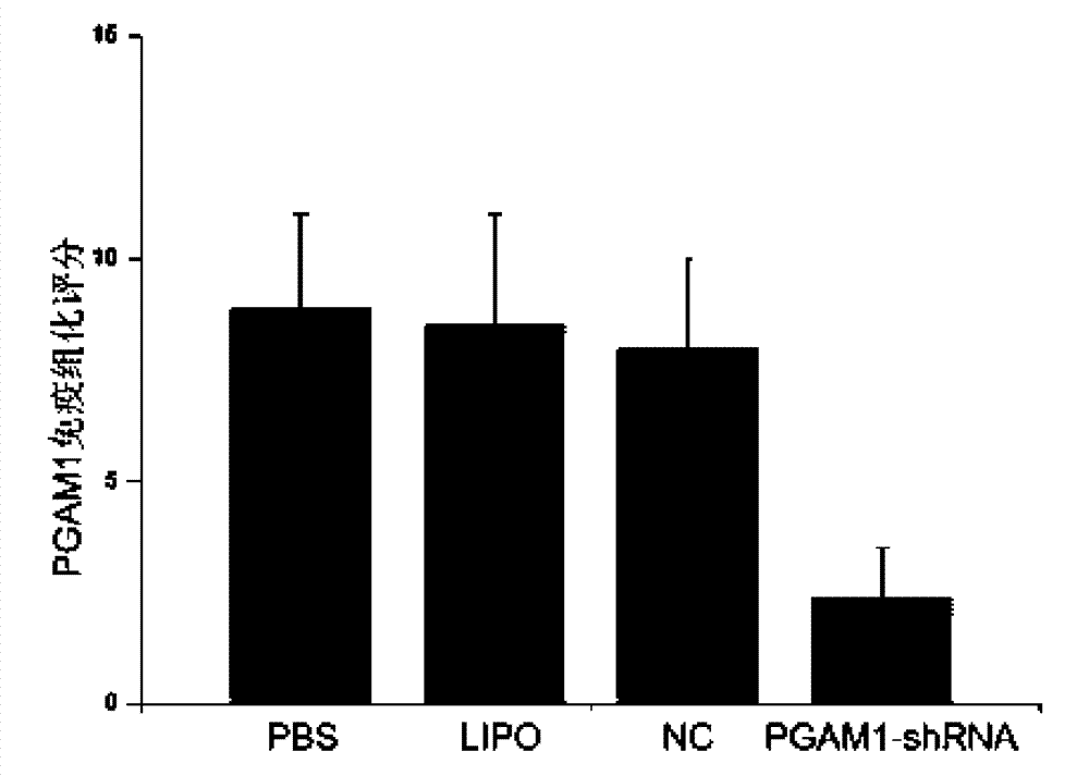 Diagnosis reagent for primary hepatocellular carcinoma, reagent kit and prevention and cure medicaments