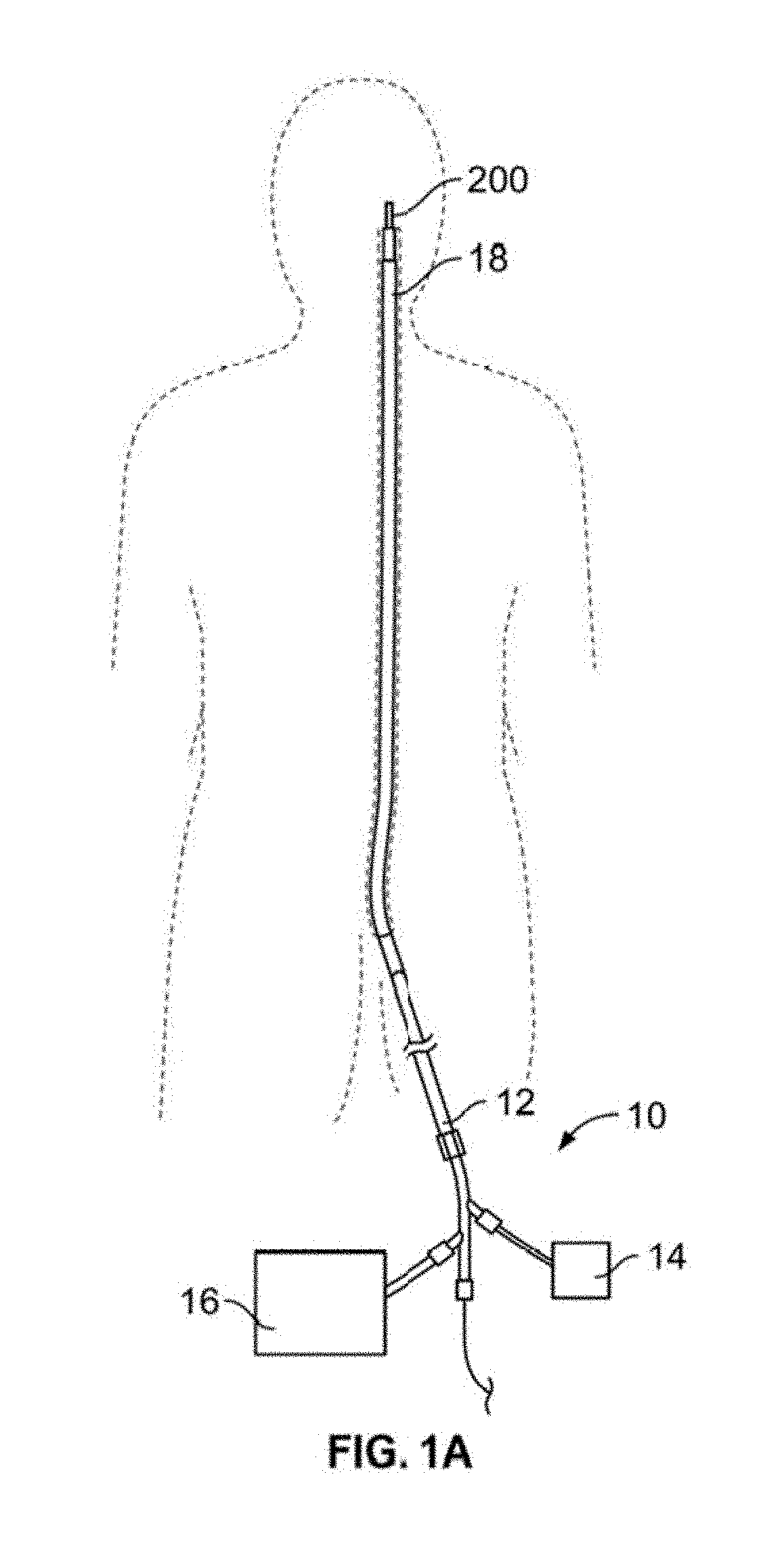 Retrieval systems and methods for use thereof