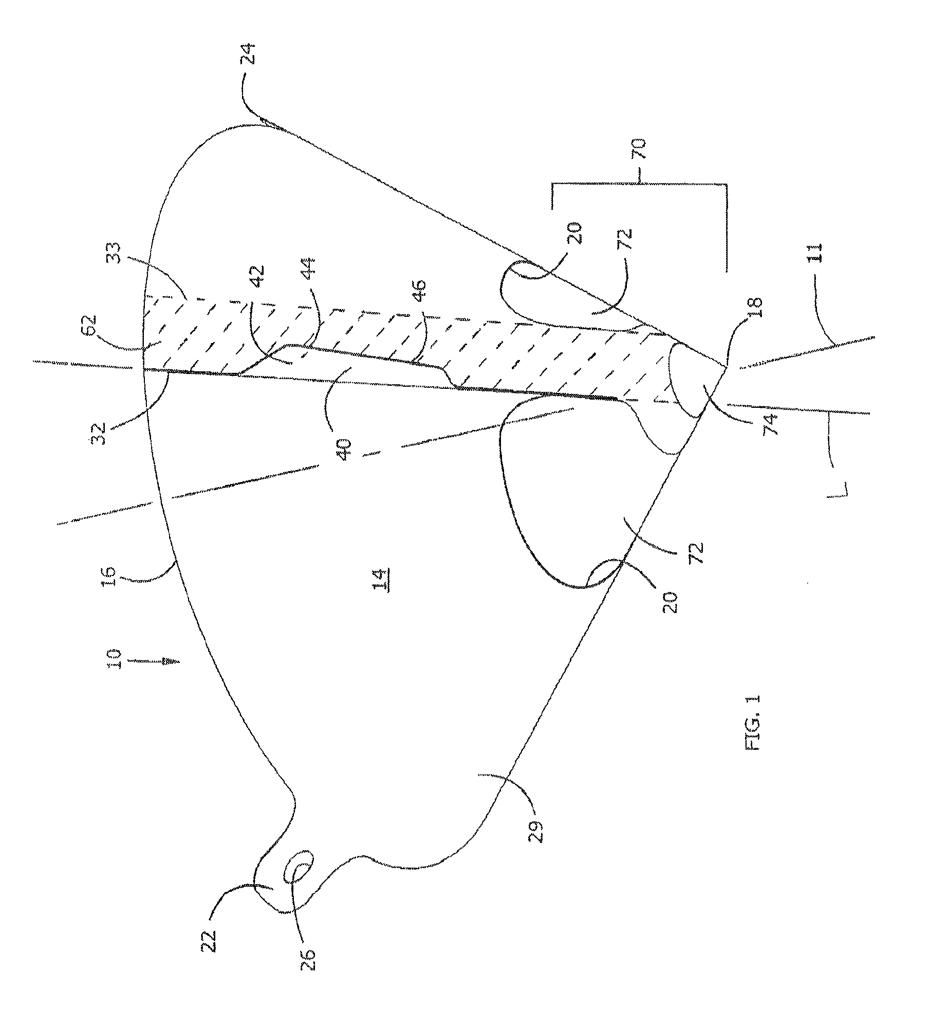 Strainer dispenser and method of use