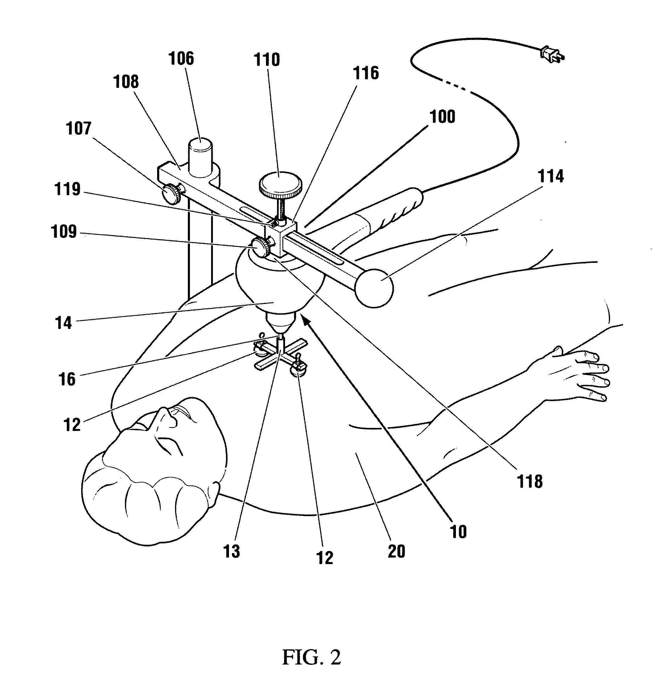 Vibration method for clearing acute arterial thrombotic occlusions in the emergency treatment of heart attack and stroke