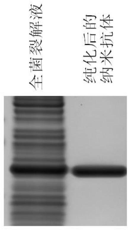 Human Serum Albumin Removal Kit