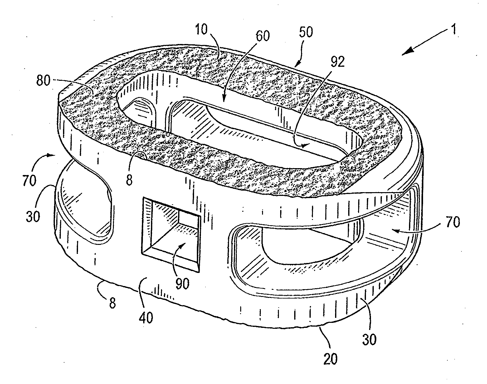 Endplate-preserving spinal implant having a raised expulsion-resistant edge