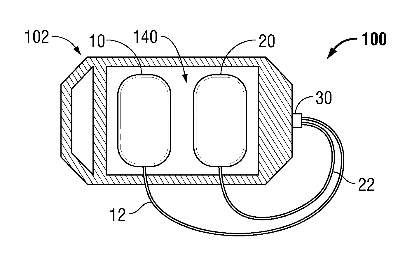 Electrode delivery system