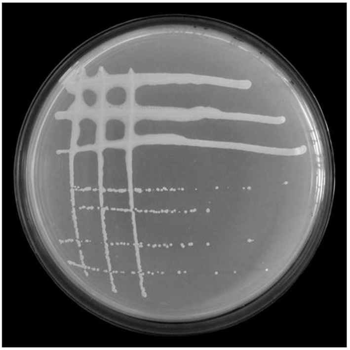 A Rhizobium wys3r1 Strain of Cassia and Its Application