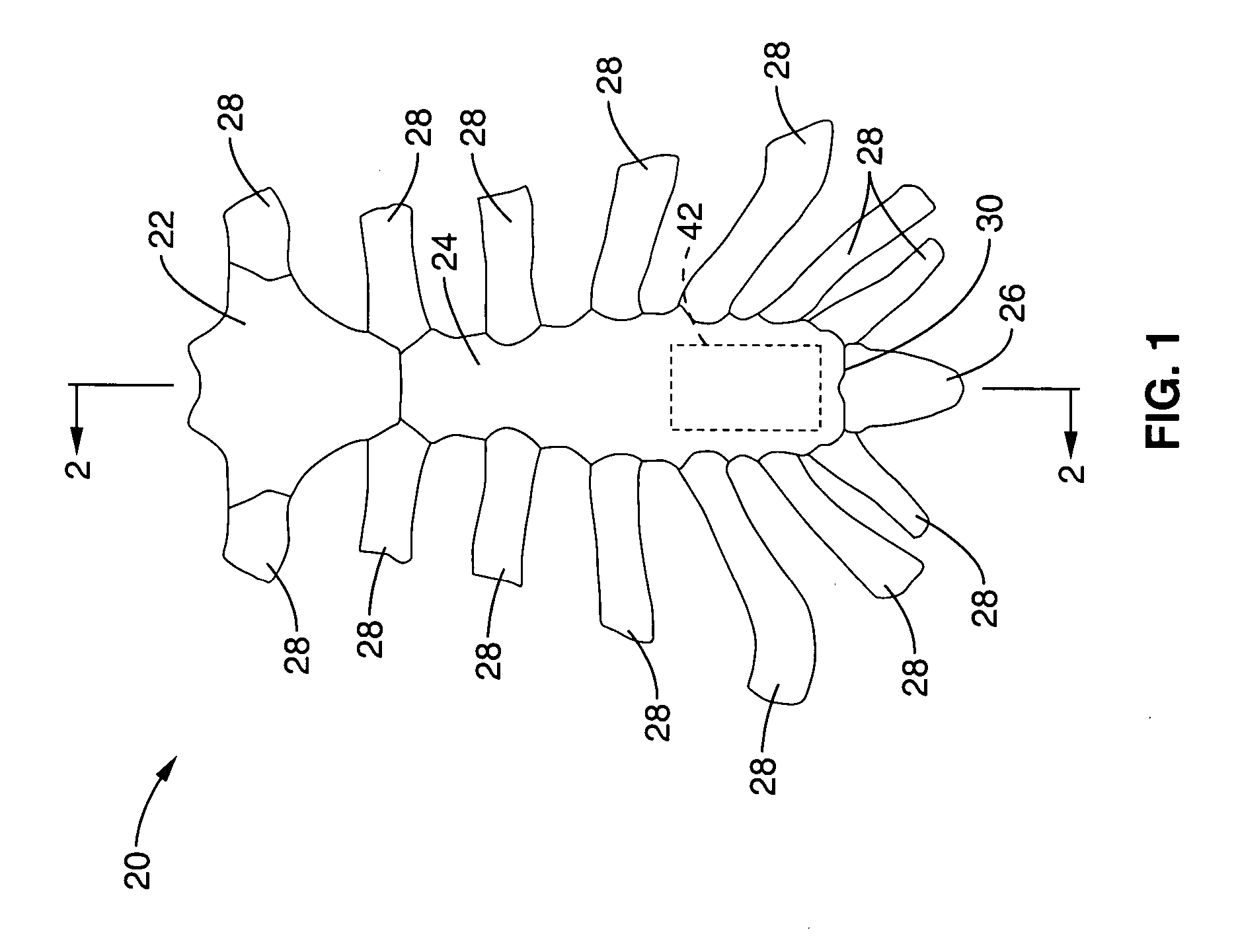 Apparatus and methods for magnetic alteration of anatomical features