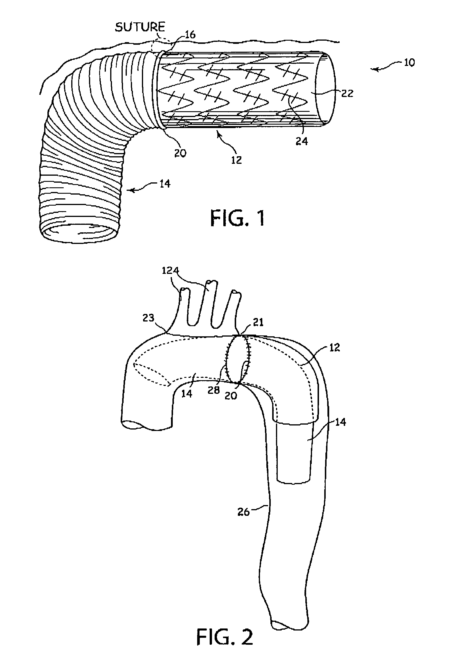 Aortic graft device