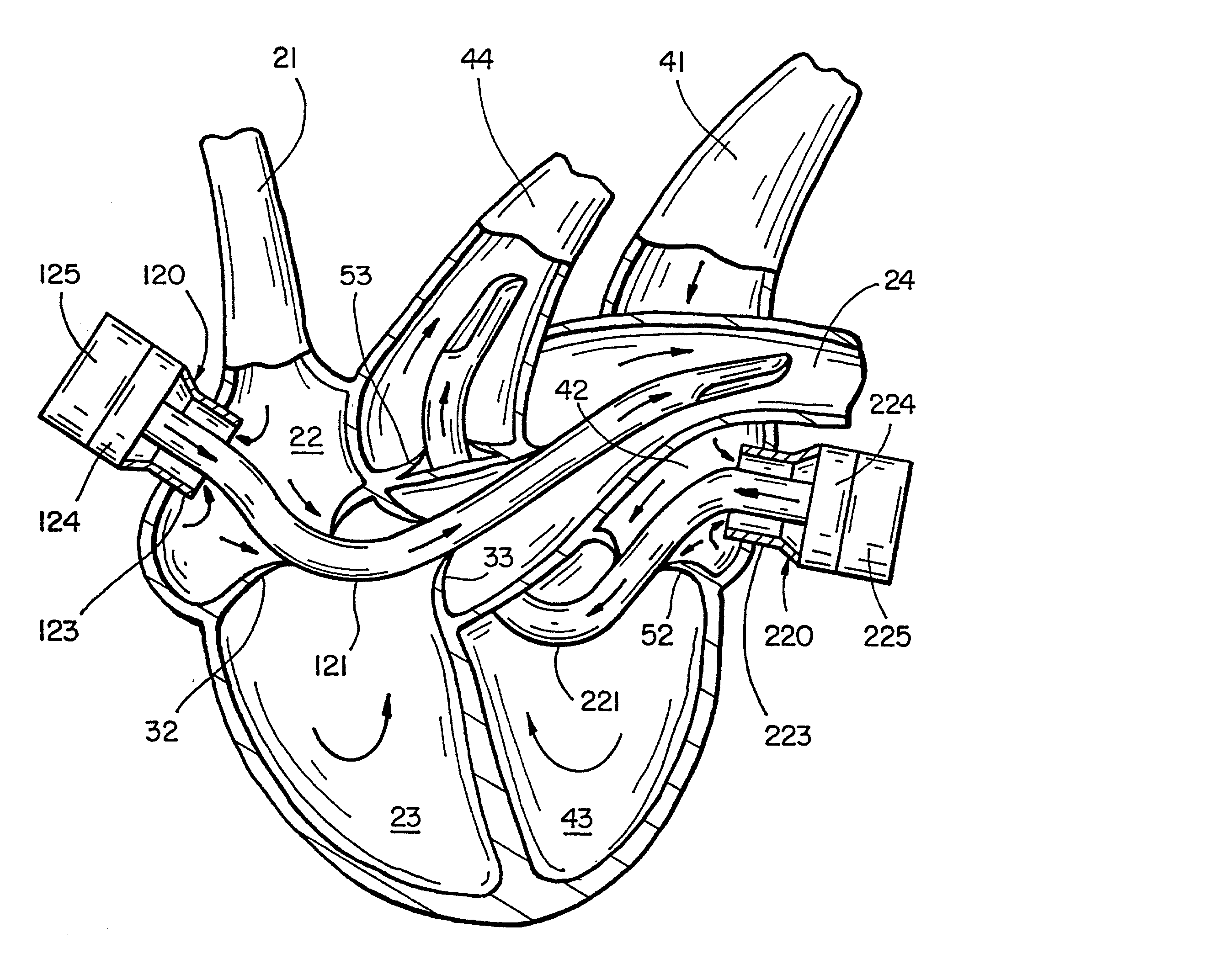 Pulmonary and circulatory blood flow support devices and methods for heart surgery procedures