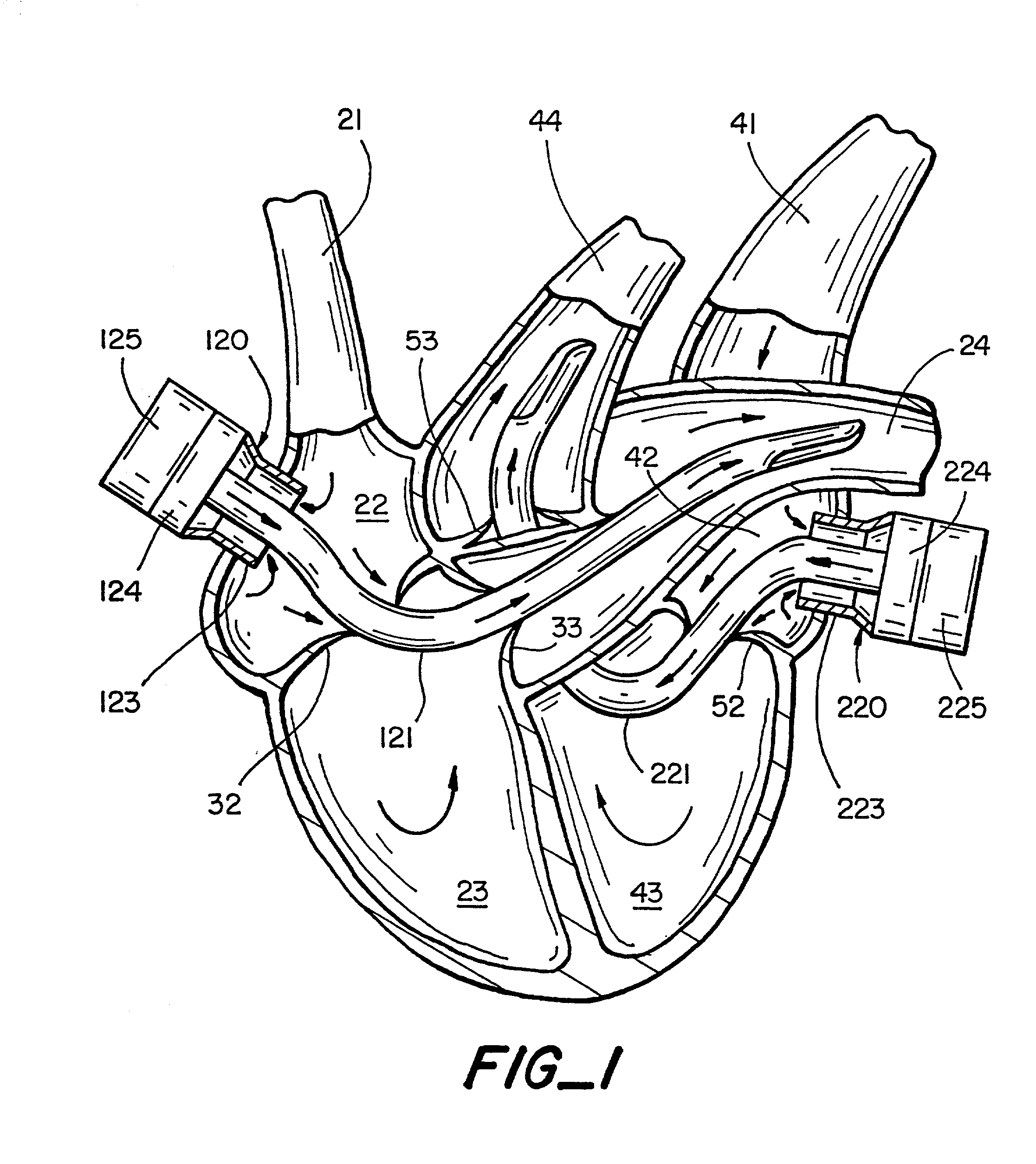 Pulmonary and circulatory blood flow support devices and methods for heart surgery procedures