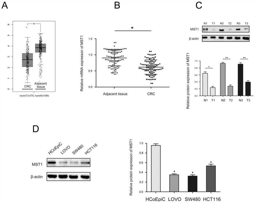 Application of MST1 as drug target in preparation of drug for treating colorectal cancer