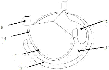 A bioprosthetic heart valve with reproducible valve leaflet replacement through minimally invasive surgery