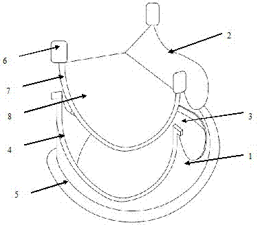 A bioprosthetic heart valve with reproducible valve leaflet replacement through minimally invasive surgery