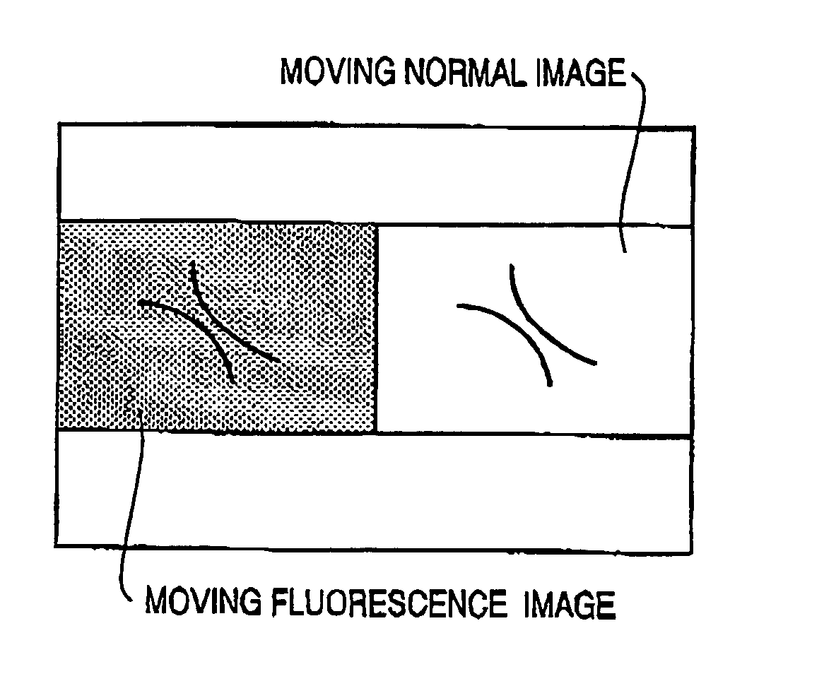 Electronic endoscope system capable of displaying a plurality of images