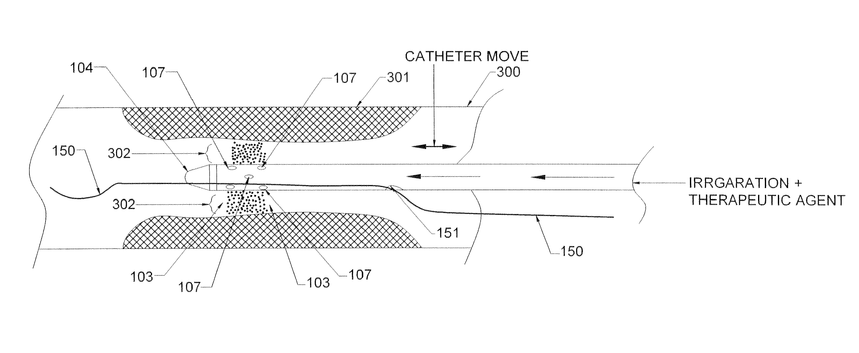 Methods and devices for endovascular therapy