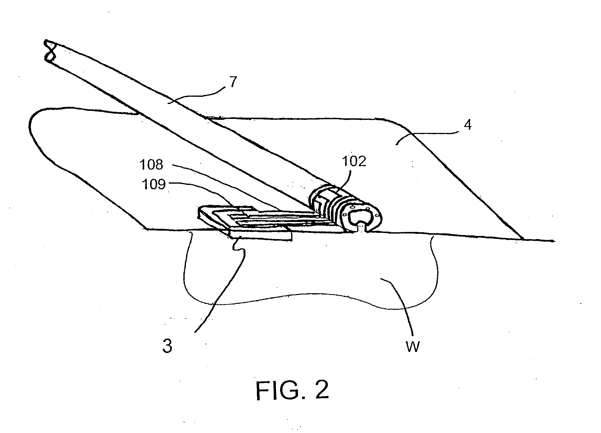 Pump system for negative pressure wound therapy and improvements thereon