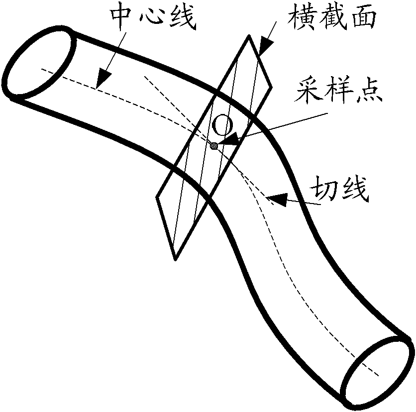 Device and method for detecting blood vessel deformation area