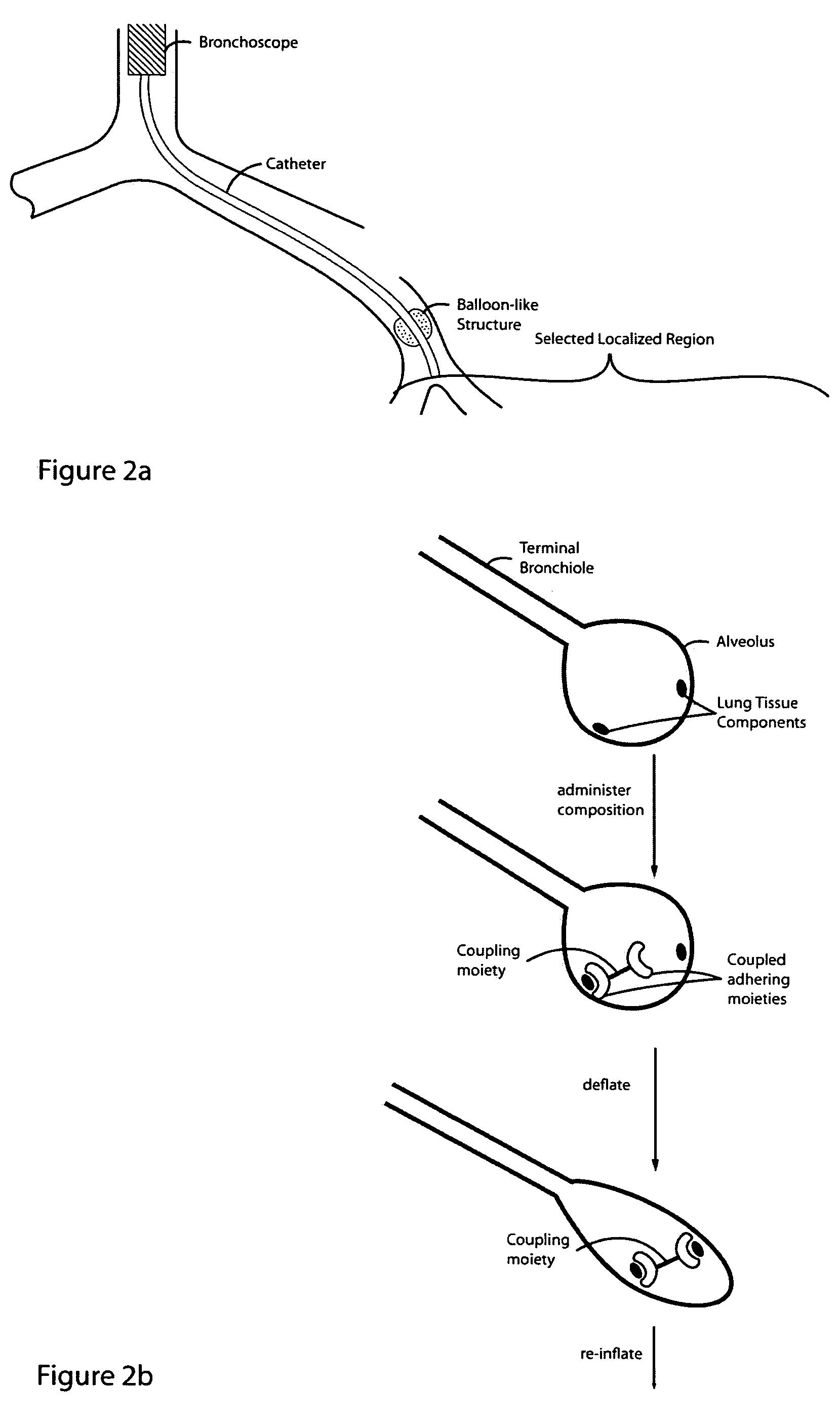 Glue composition for lung volume reduction