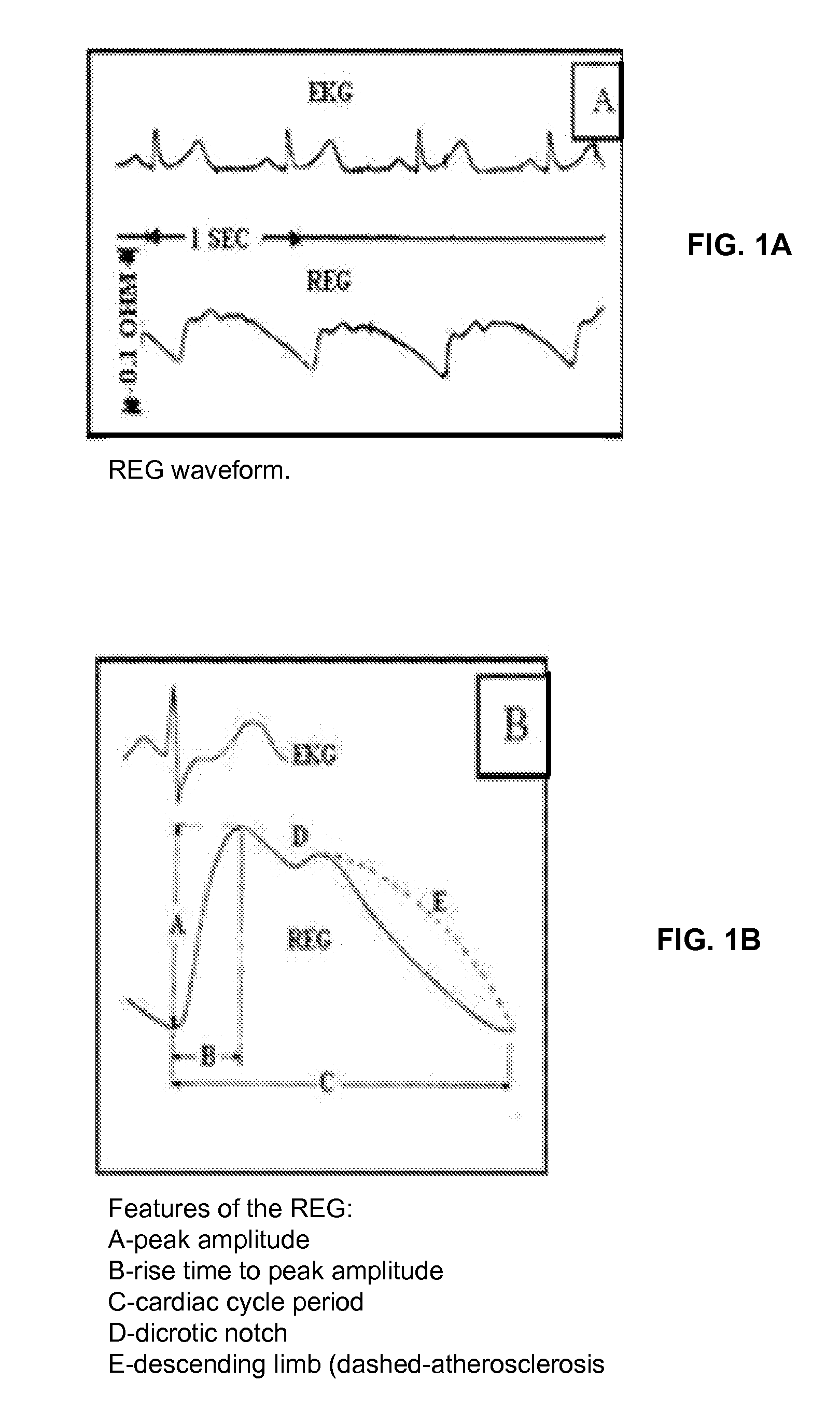 Method and Apparatus For Non-Invasive Assessment of Hemodynamic and Functional State of the Brain